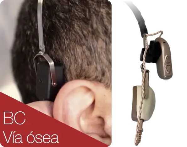 audifono modelo bc via osea